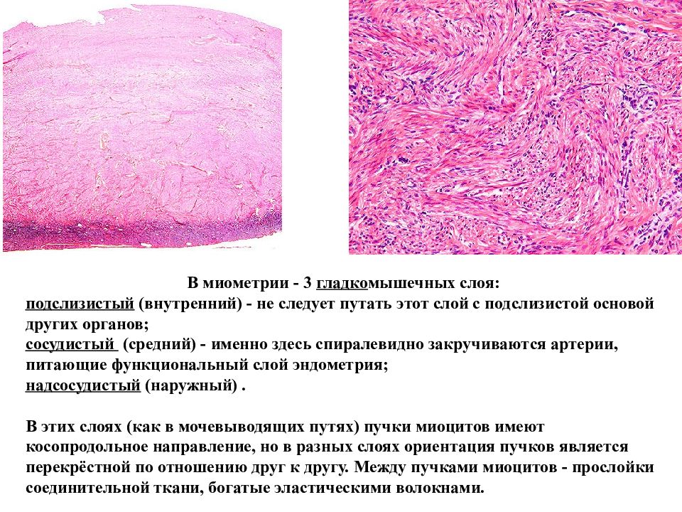 Подслизистая лейомиома матки что это. Строение миометрия гистология. Миометрий матки гистология. Слои миометрия матки гистология.