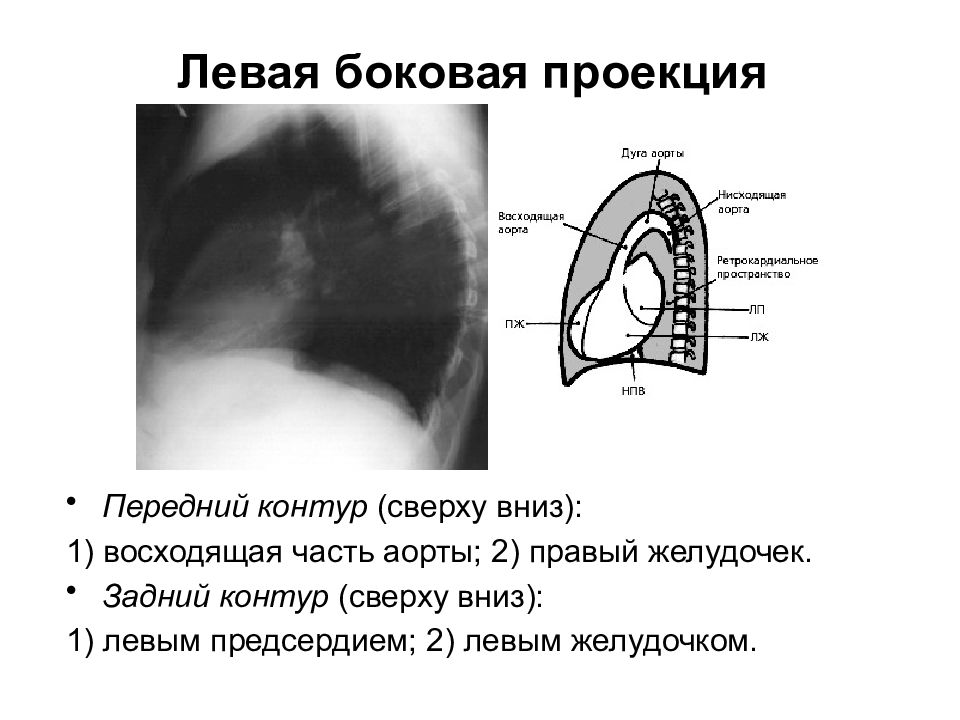 Прямая и боковая проекция. Левая боковая проекция. Левая боковая проекция сердца. Левая боковая проекция сердца рентген.