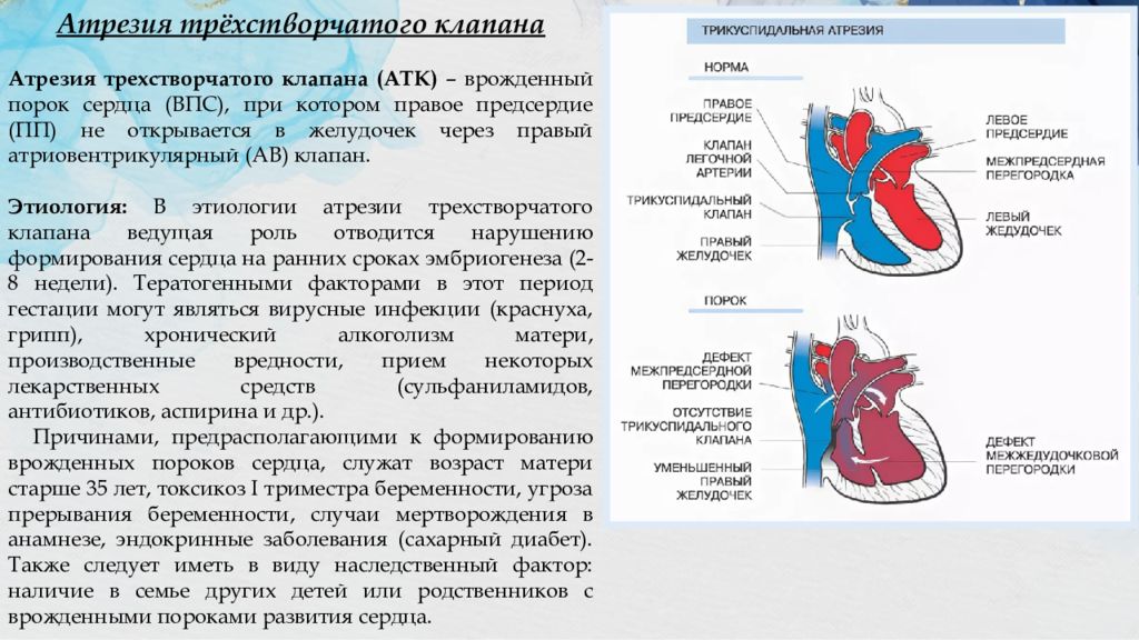 Причины порока сердца