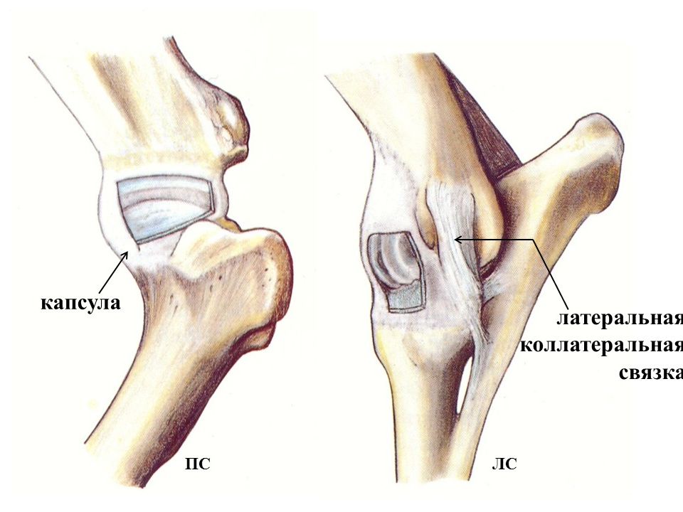 Кости локтевого сустава. Разрыв колатеральный связки локтевого сустава. Связки локтевого сустава анатомия. Локтевой сустав (articulatio cubiti). Связочный аппарат локтевого сустава.