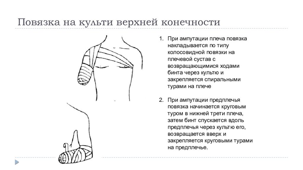 Повязка на культю конечности. Возвращающаяся повязка на культю бедра. Технику наложения повязки на культю (при ампутации плечевой кости).. Возвращающаяся повязка на культю голени. Возвращающаяся повязка на культю плеча.