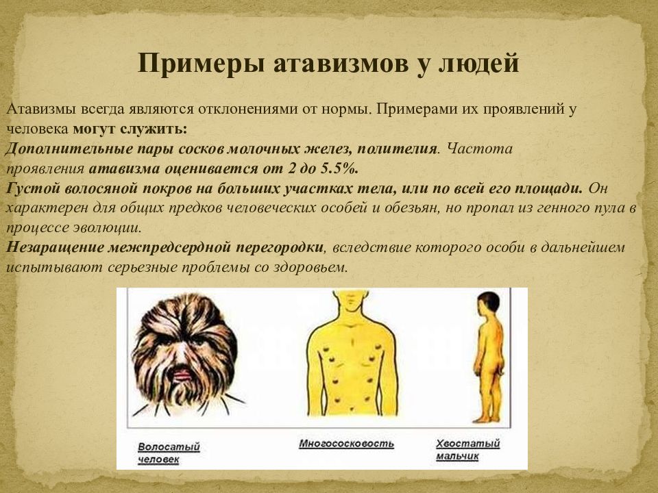 Атавизмы человека аппендикс. Атавизмом у человека является. Проявление атавизма у человека. Атомизм у человека примеры.