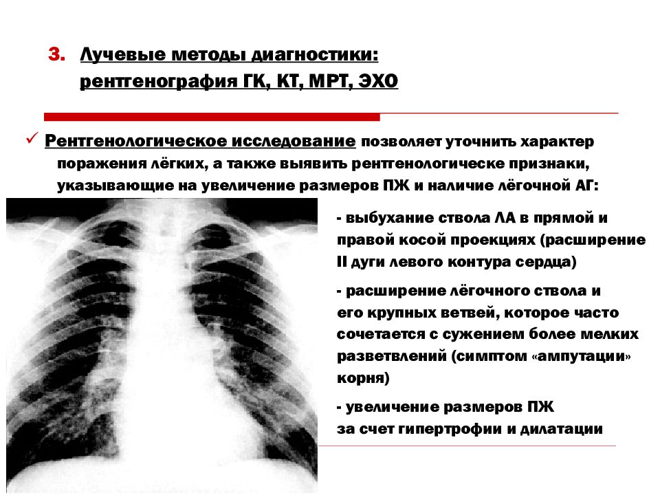 Сердечно легочная недостаточность презентация