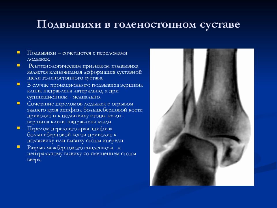 Повреждения нижних конечностей презентация