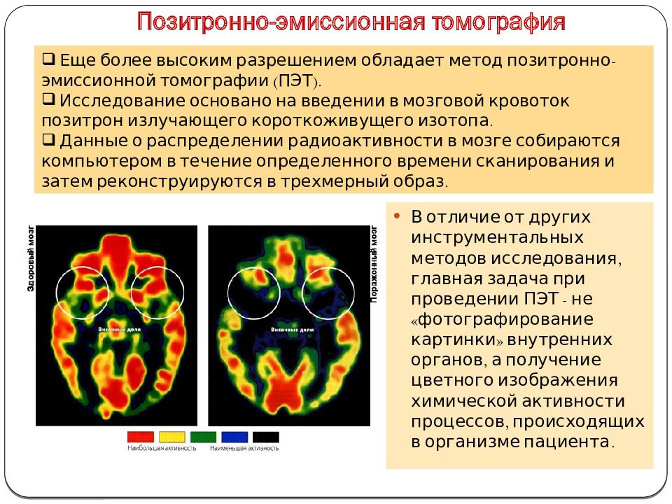 Методы позитронно эмиссионной томографии