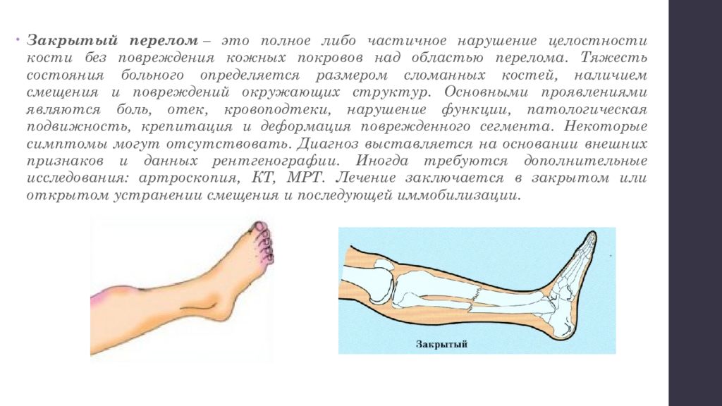 Закрытый перелом. Сообщение на тему закрытый перелом. Презентация на тему ушибы и переломы.