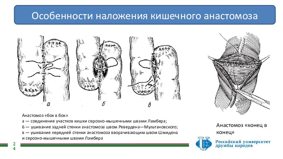Шов мышцы. Лимфовенозный анастомоз. Анастомоз кровеносных сосудов. Анастомоз мочеточника.