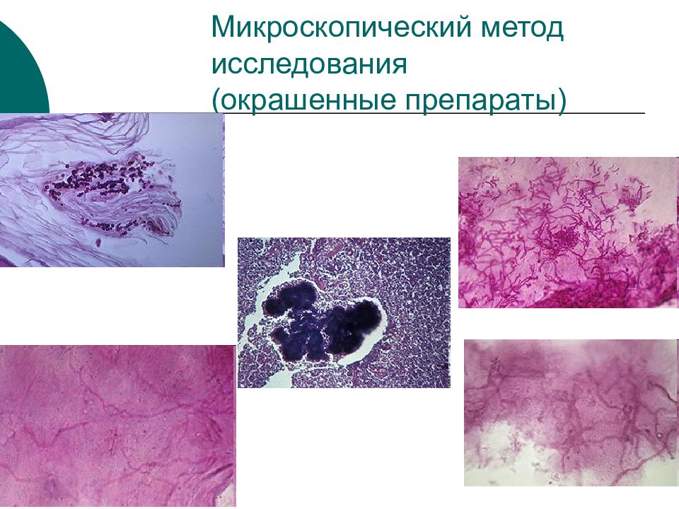 Микроскопическое исследование окрашенных препаратов. Окраска по цилю-нильсену при туберкулезе. Окраска по методу циля-нильсена. Микроскопия мокроты эластические волокна. Микроскопия мокроты волокнистые образования.