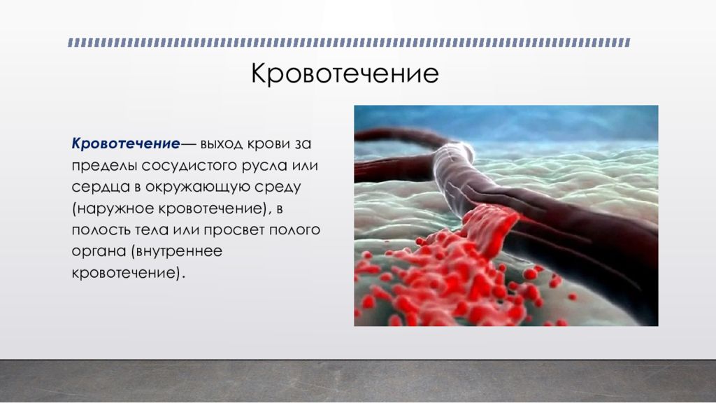 Кровотечение это. Кровотеченияпрезинтаия. Кровотечения презентация. Кровопотеря презентация.