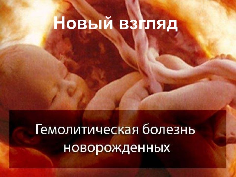 Новый взгляд