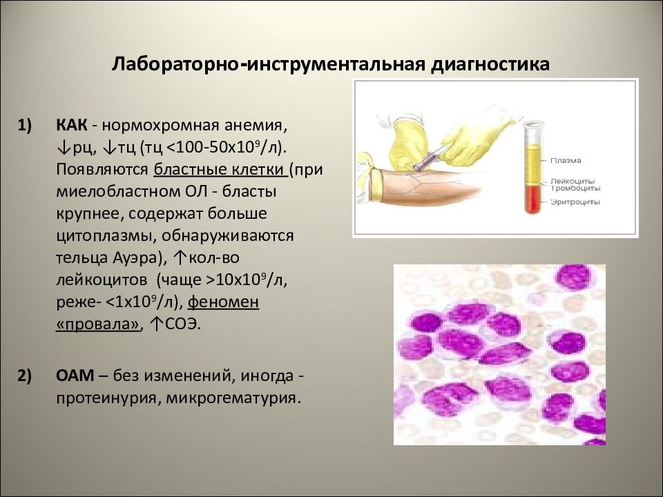 Отличие картины крови при лейкемоидных реакциях от аналогичной при лейкозах