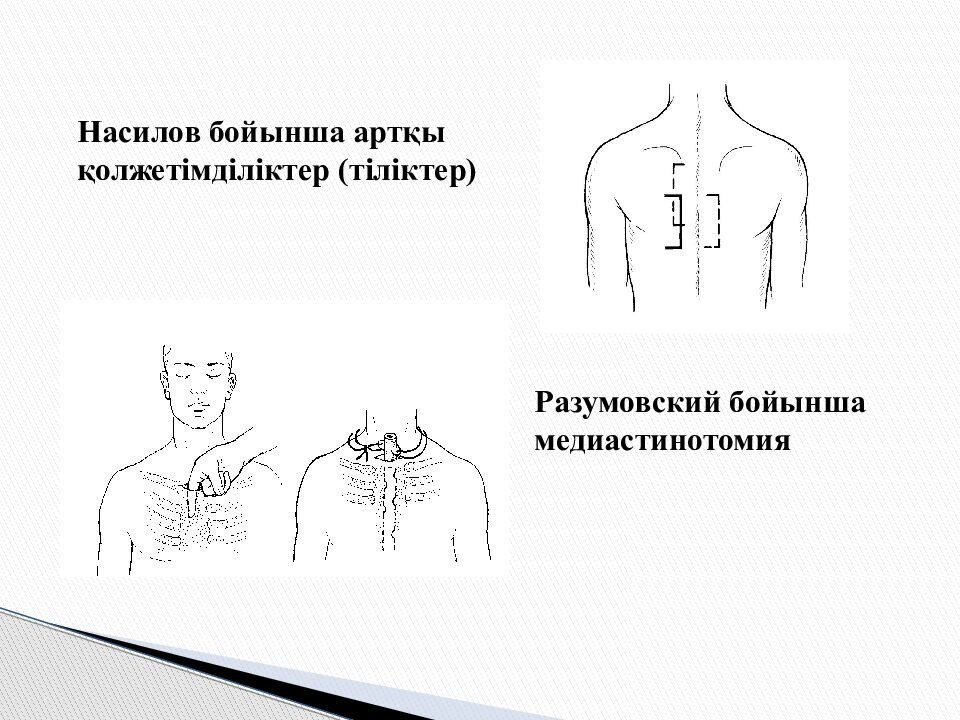 Тақырыбы: Іріңді медиастинит