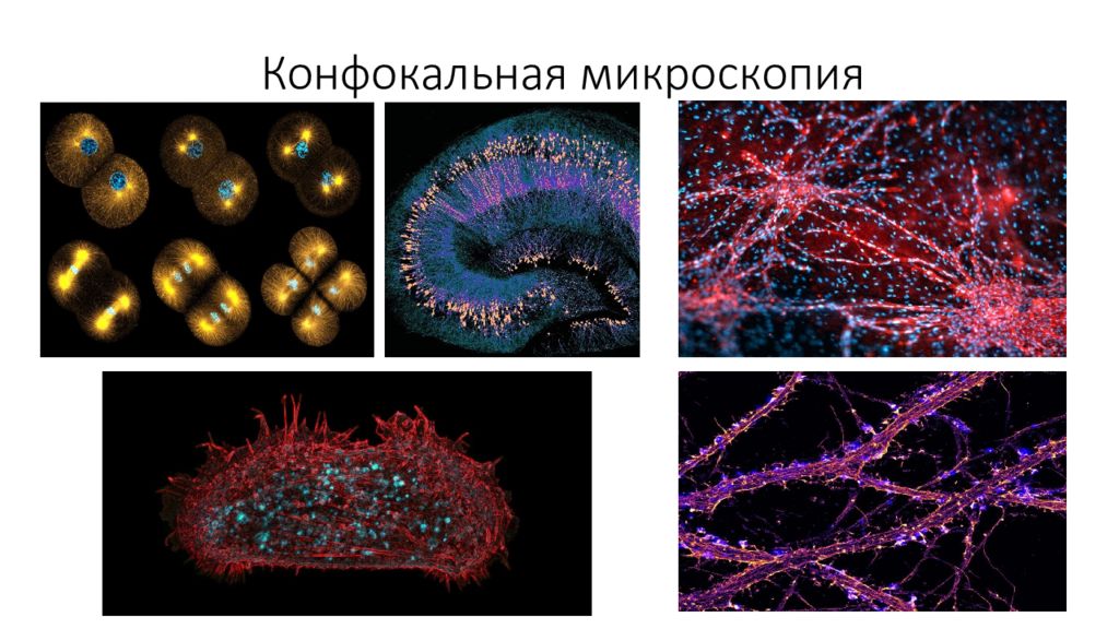 Изображения полученные с помощью. Конфокальная сканирующая микроскопия. Лазерная конфокальная микроскопия. Метод конфокальной сканирующей микроскопии. Конфокальная микроскопия в микробиологии.