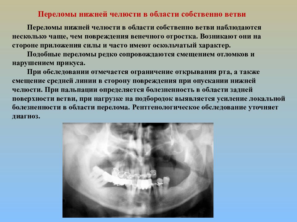 Функциональные нарушения при повреждениях челюстно лицевой области презентация