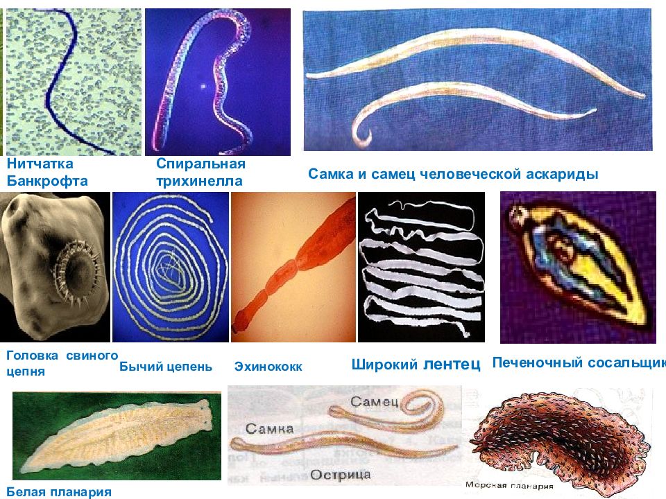 Круглые черви презентация медицина