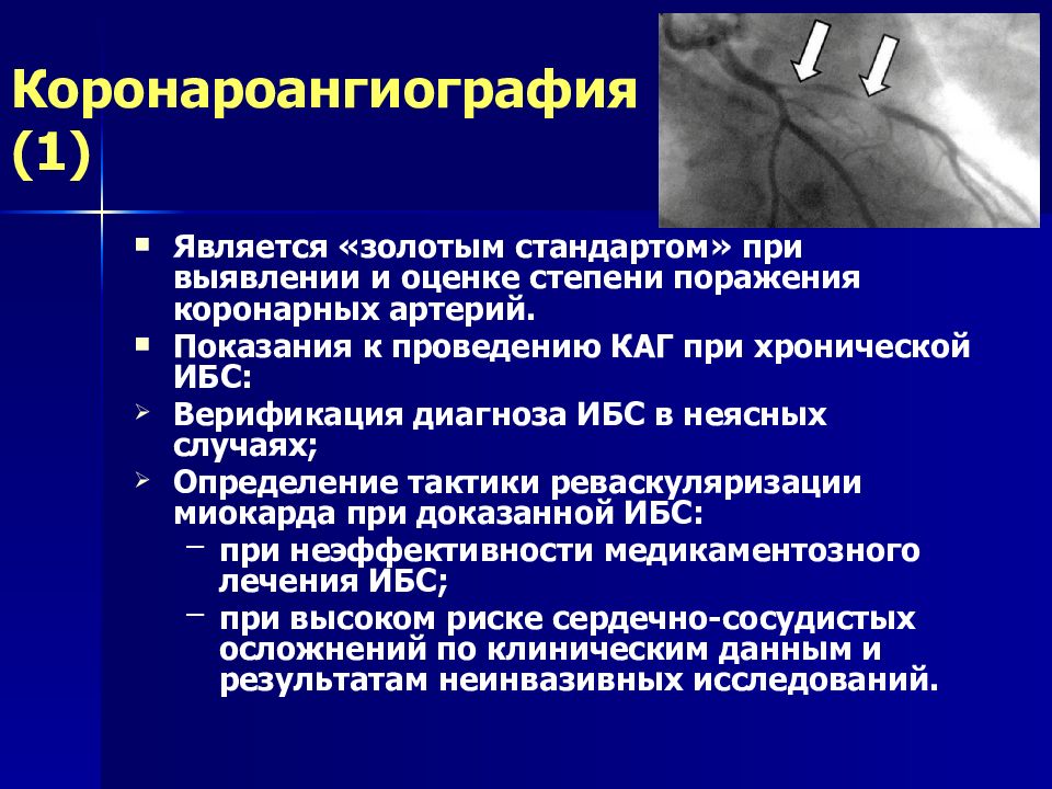 Что такое коронарография. Коронароангиография ИБС. Коронарная ангиография при ИБС.