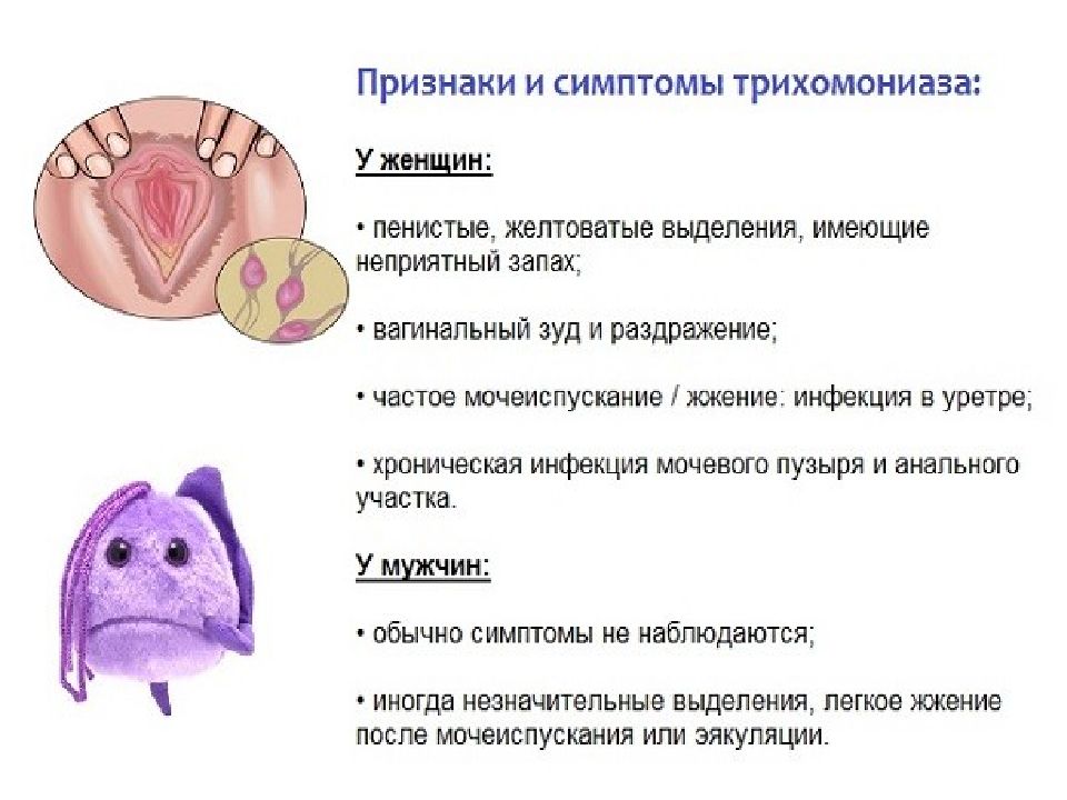 Трихомониаз у женщин. Трихомониаз полипы молочница. Трихомоноз источник инфекции. Трихомониаз симптомы у женщин.