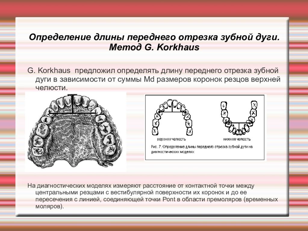 Метод пона. Измерение длины зубной дуги. Ширина зубной дуги. Форма верхней зубной дуги. Длина переднего отрезка зубной дуги.