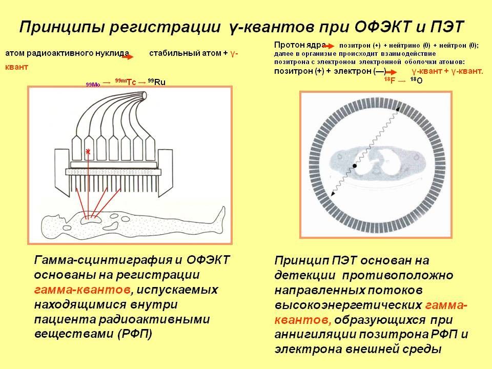 Офэкт кт что это такое