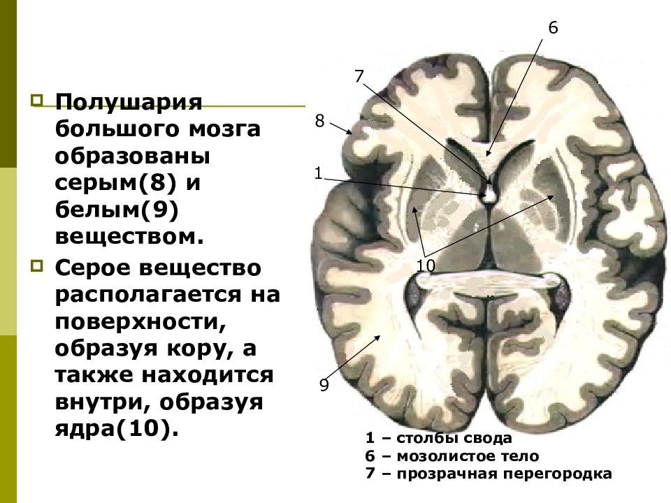 Общая схема локализации белого и серого вещества головного мозга