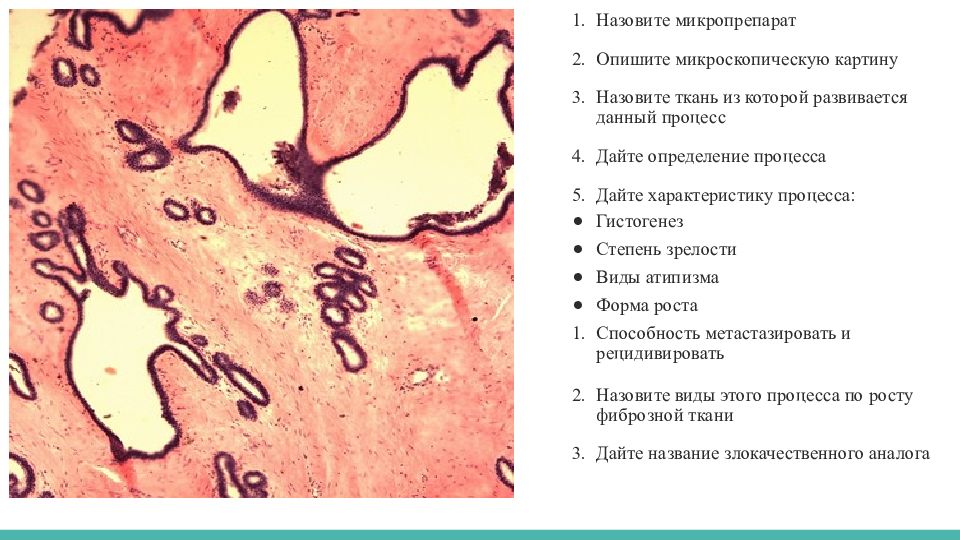 Опишите клиническую картину. Описание микроскопической микроскопическое картины. Коллоквиум ткани гистология. Микроскопическая картина мыл характеризуется. Определите 5 микропрепаратов определите ткань.