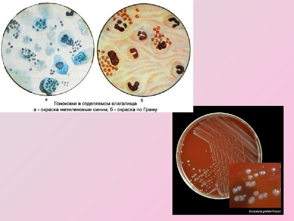 Гонококки презентация микробиология