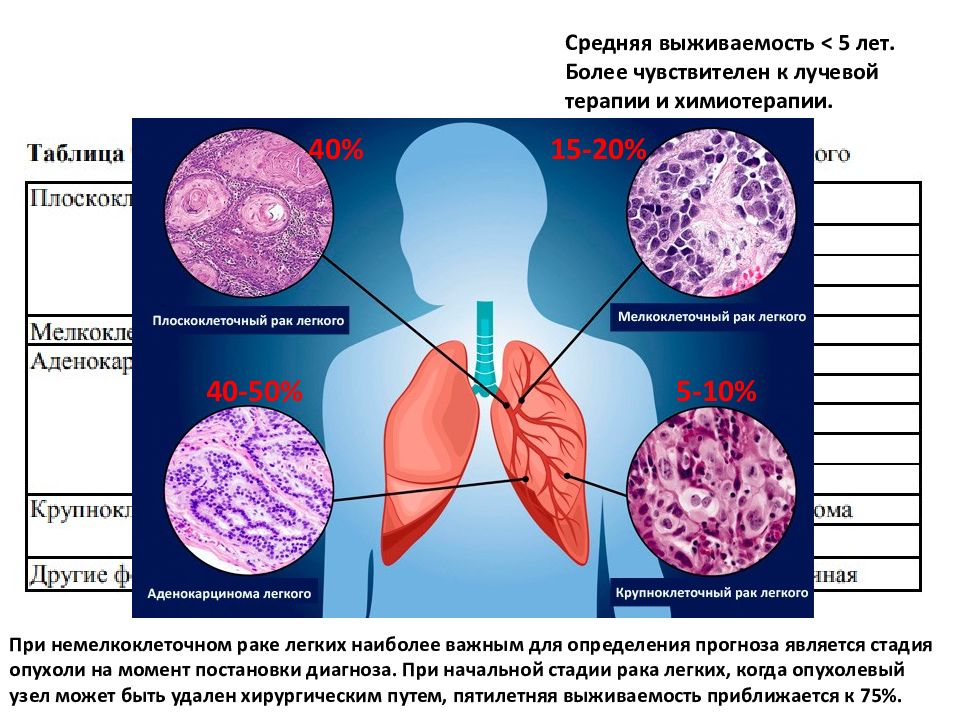 Стадии рака бронха. Стадия IB В онкологии легких. Что такое BL В онкологии легких.