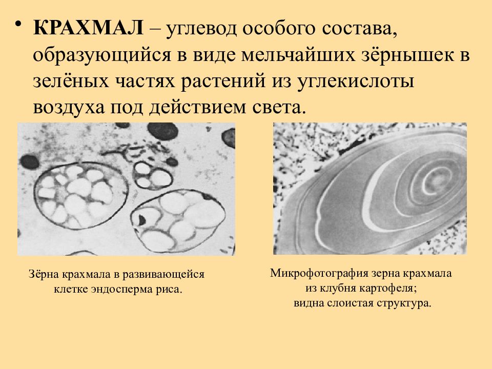 Крахмальные зерна. Крахмальные зерна где. Крахмальные зерна находятся в. Крахмальные зерна строение и функции.