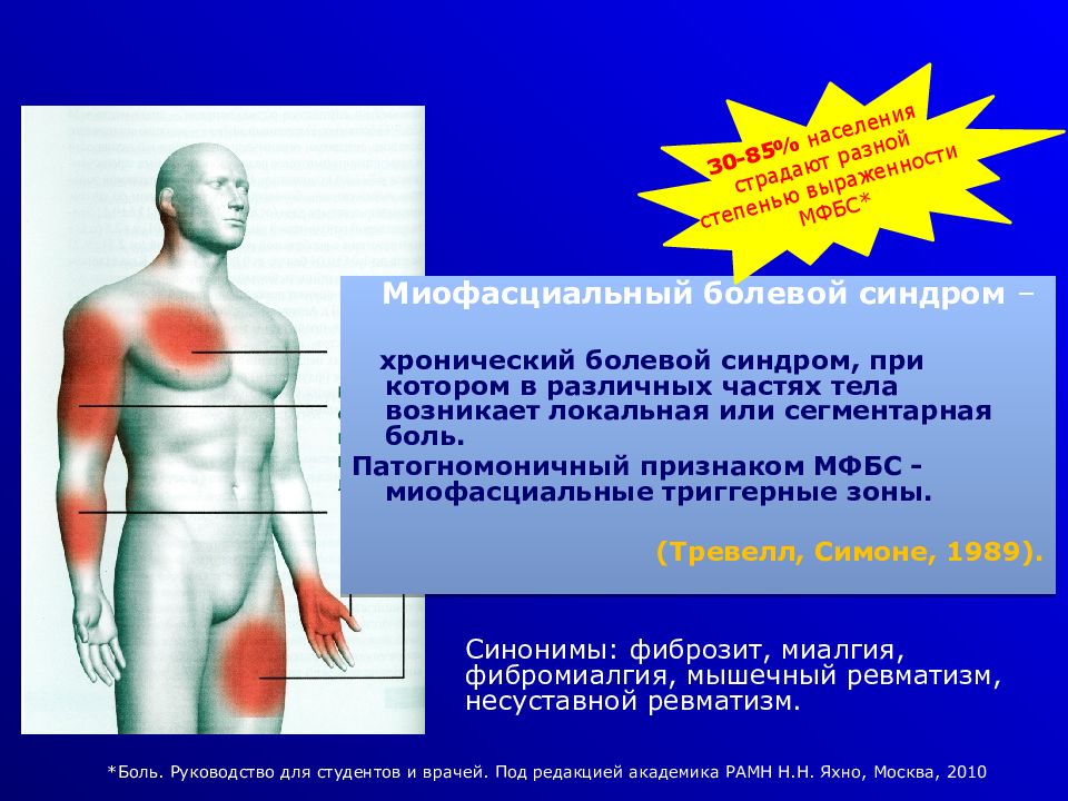 Миофасциальный болевой синдром презентация