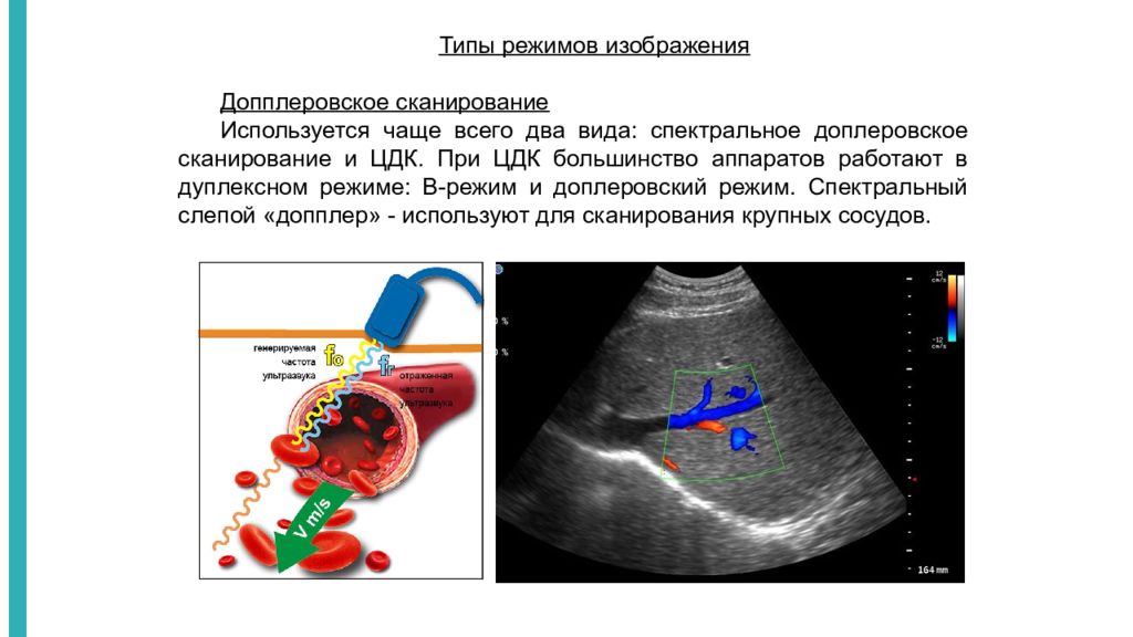 Для получения изображений в ультразвуковых сканерах используются