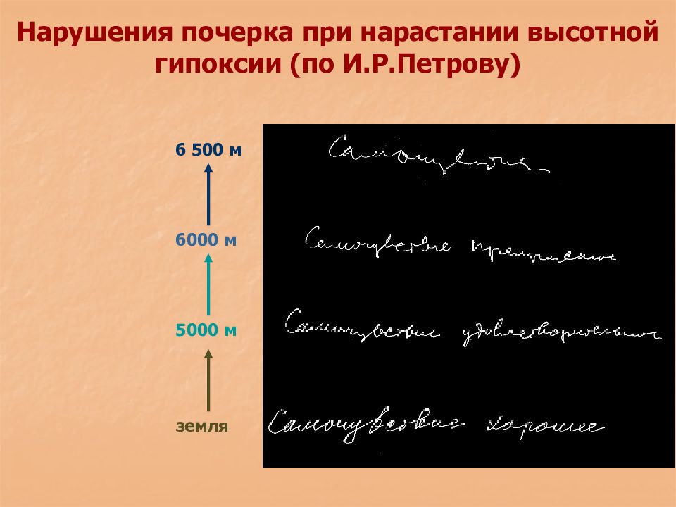 нарушение почерка при гипоксии. почерк дисграфика. лбщщре признаки пояерка. нарушение письма. нарушение почерка.