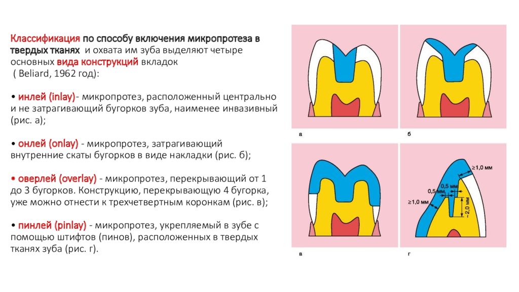 Патология твердых тканей. Классификация дефектов твердых тканей коронки зуба. Дефекты твердых тканей коронки зуба ортопедическая стоматология. Классификация дефектов твердых тканей зубов по Куриленко. Клиника дефектов твердых тканей коронки зуба..