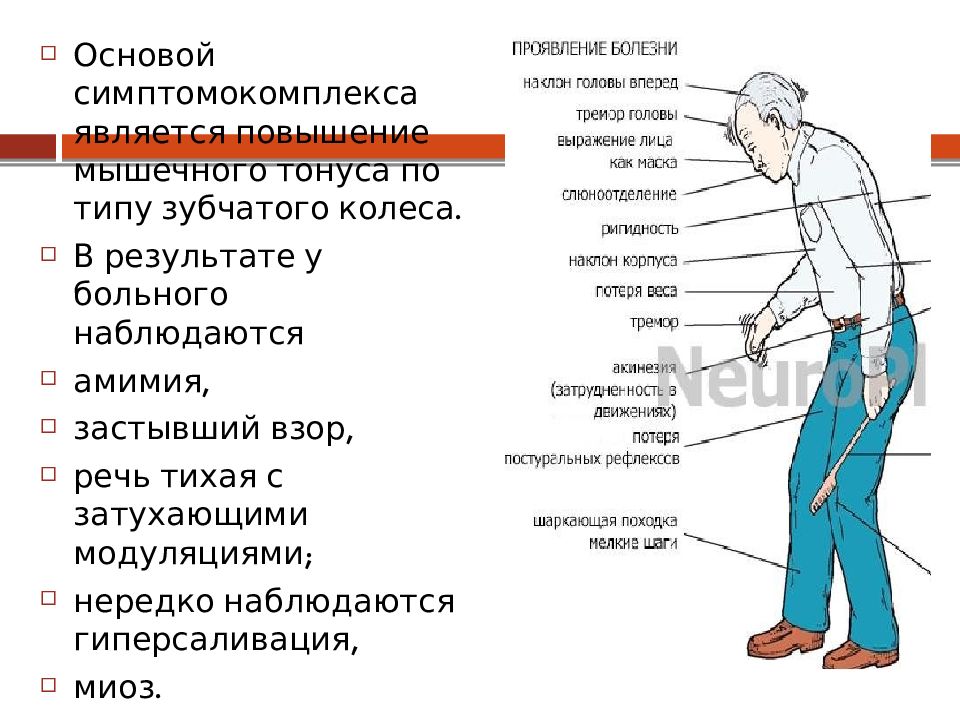 Симптом зубчатого