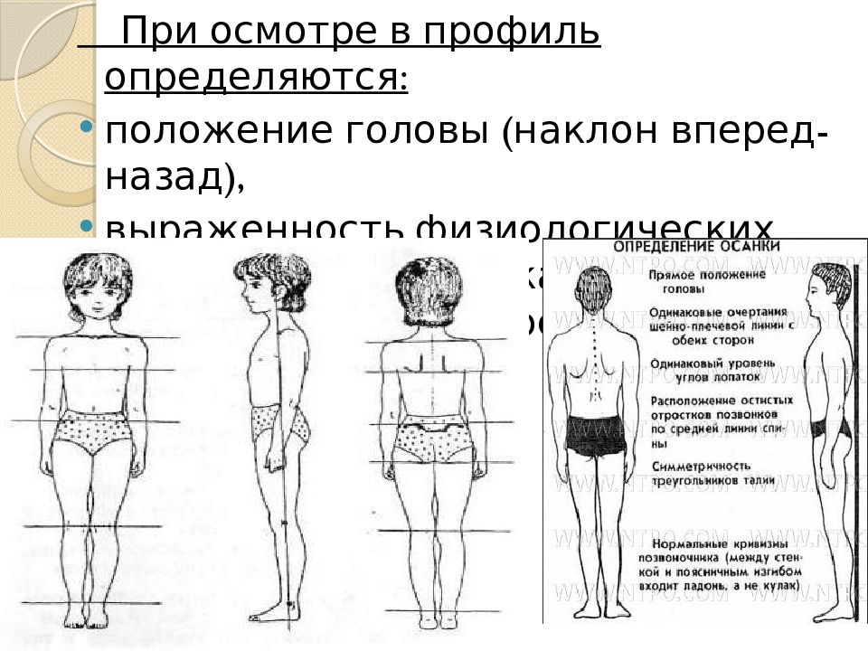 Признаки осанки. Треугольники талии. Нарушение осанки реабилитация. Треугольники талии симметричность. Осмотр при нарушениях осанки.