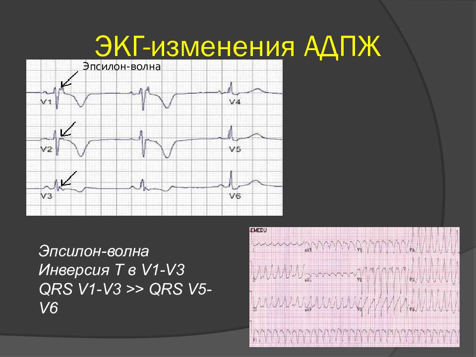 Т б волна