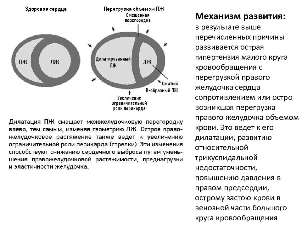 Острая левожелудочковая недостаточность карта вызова скорой помощи