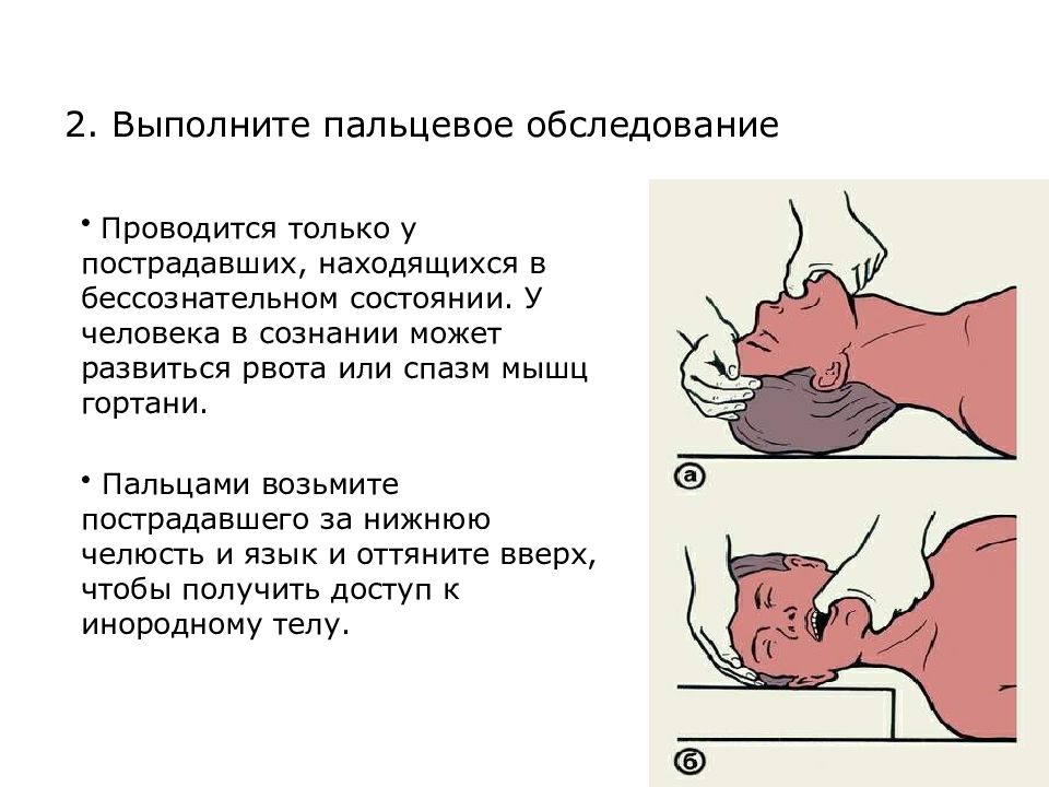 Находился в бессознательном состоянии. При закупорке дыхательных путей. Закупорка дыхательных путей инородным телом. Помощь при закупорке дыхательных путей. Бессознательном состоянии пострадавшего.