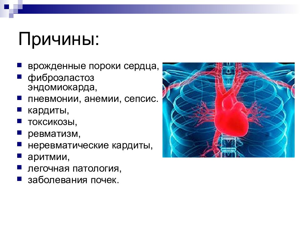 Презентация сестринский процесс при пороках сердца