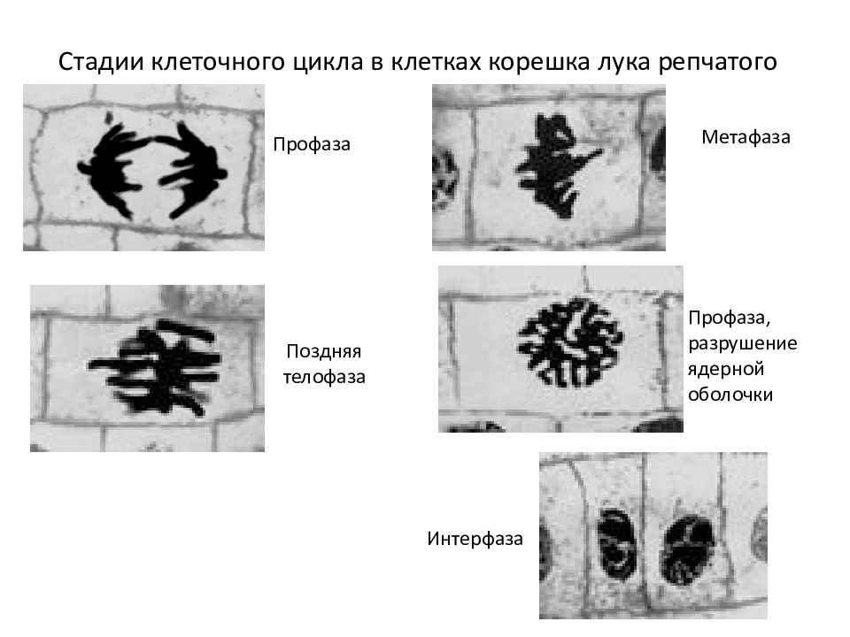 Наблюдение митоза в клетках кончика корешка. Стадии клеточного цикла в клетках корешка лука. Фазы митоза в клетках корешка лука. Профаза митоза в корешке лука. Профаза в клетках корешка лука.