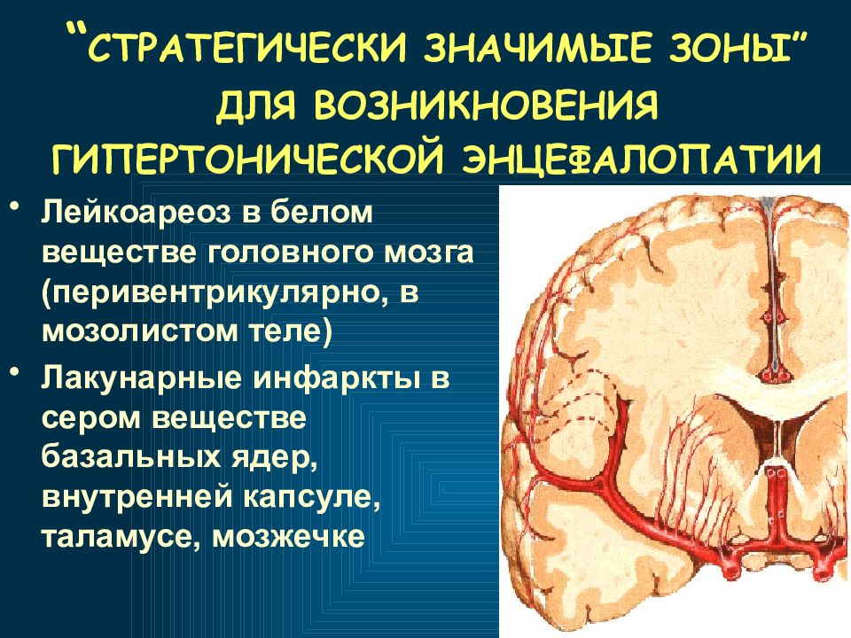 Хроническая ишемия мозга презентация