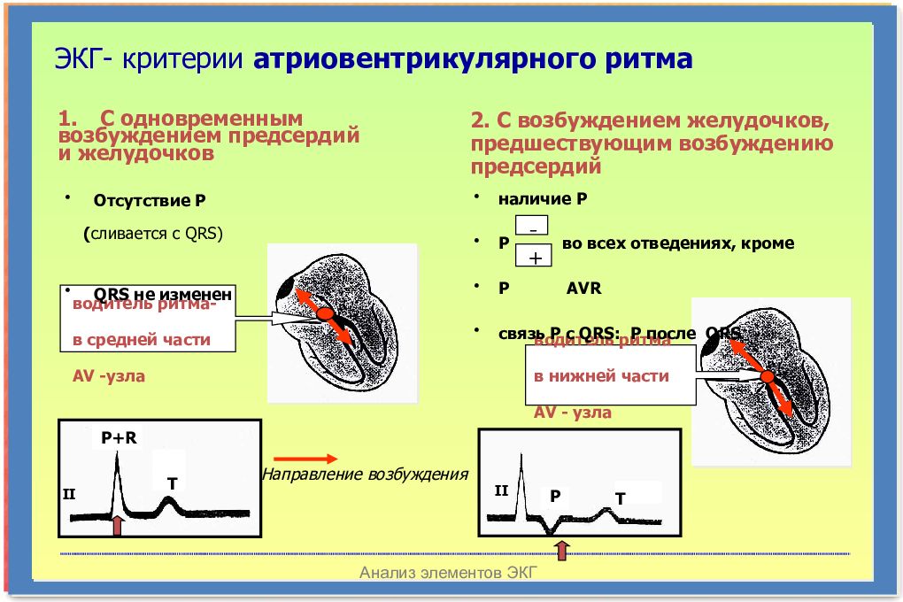 Экг нарушение проводимости. Возбуждение желудочков на ЭКГ. Нарушение проводимости на ЭКГ. Критерии ЭКГ. Нарушение атриовентрикулярной проводимости.