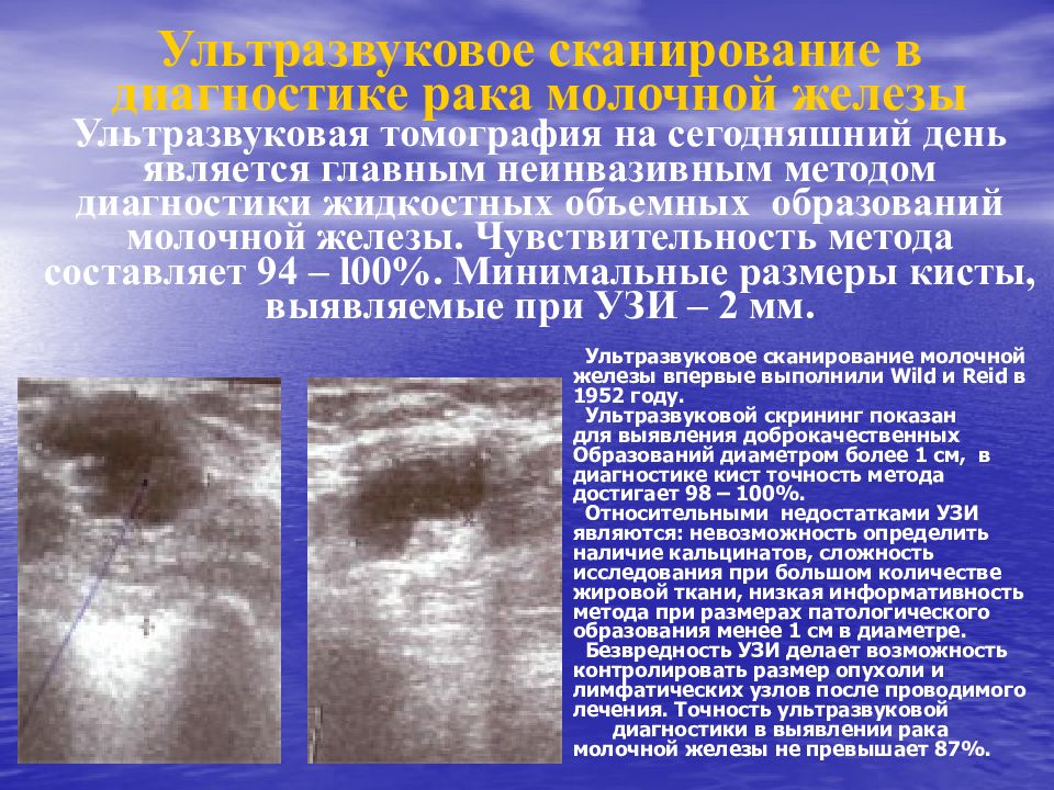 Презентация на тему онкология молочной железы