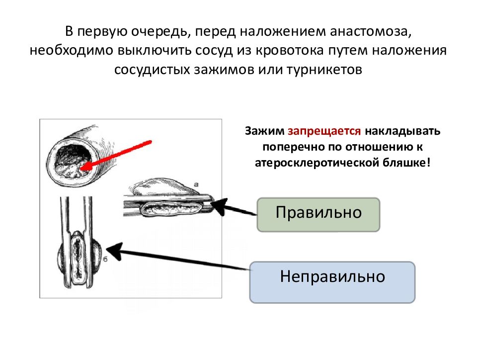 Оперативная хирургия нижней конечности презентация