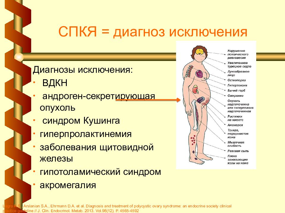 Поликистоз яичников презентация