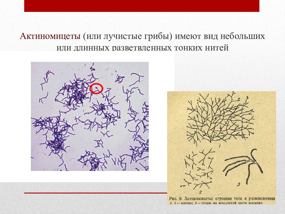 Антибиотиков полученных из актиномицет. Актиномицеты форма бактерий. Актиномицеты морфология. Актиномицеты микроскопия. Грибы актиномицеты.