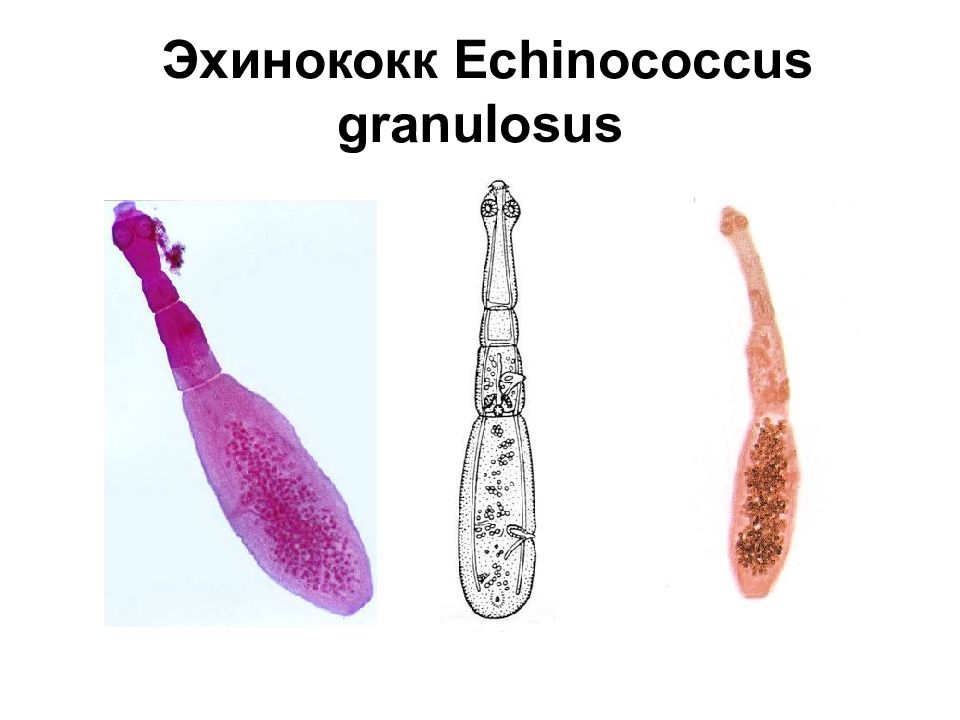 Признаки характерные для эхинококка в живом организме. Плоский червь эхинококк. Ленточный червь эхинококк. Эхинококк Тип червей плоские. Ленточный червь Echinococcus granulosus.