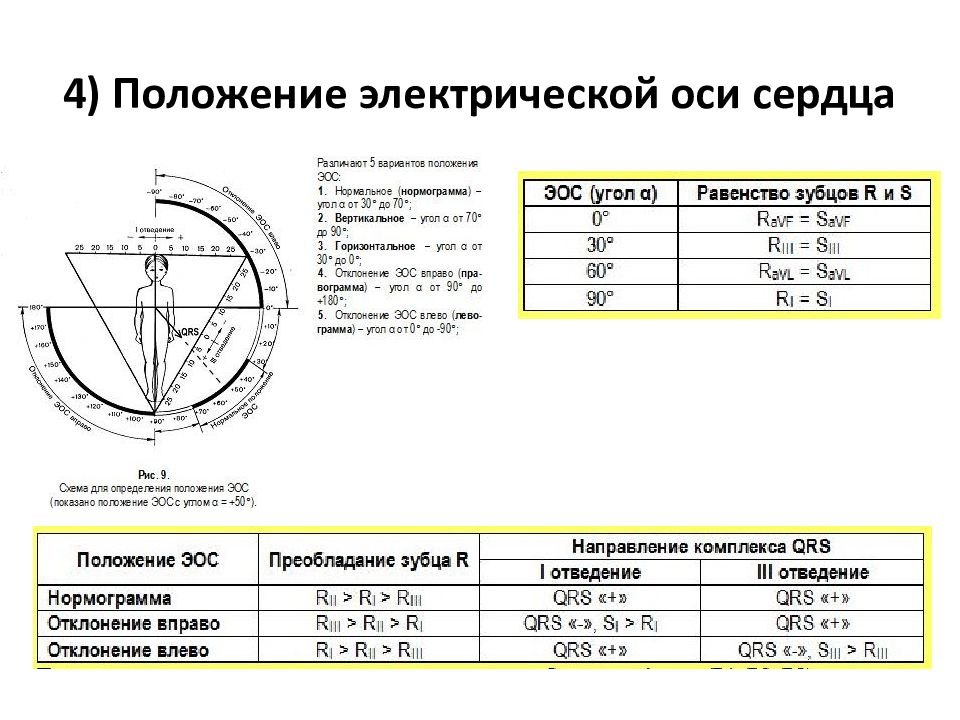 Электрическая ось сердца горизонтальная