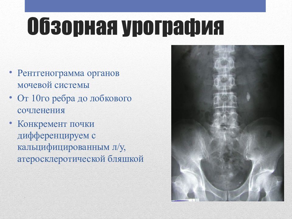 Внутривенная урография презентация