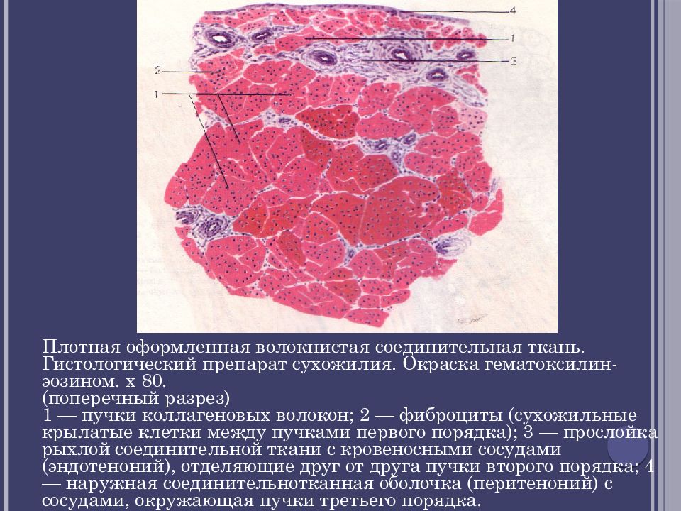 Плотно оформленная. Плотная оформленная соединительная ткань препарат. Плотная оформленная соединительная ткань сухожилия теленка. Плотная волокнистая оформленная ткань поперечный срез. Плотная соединительная ткань гистология.
