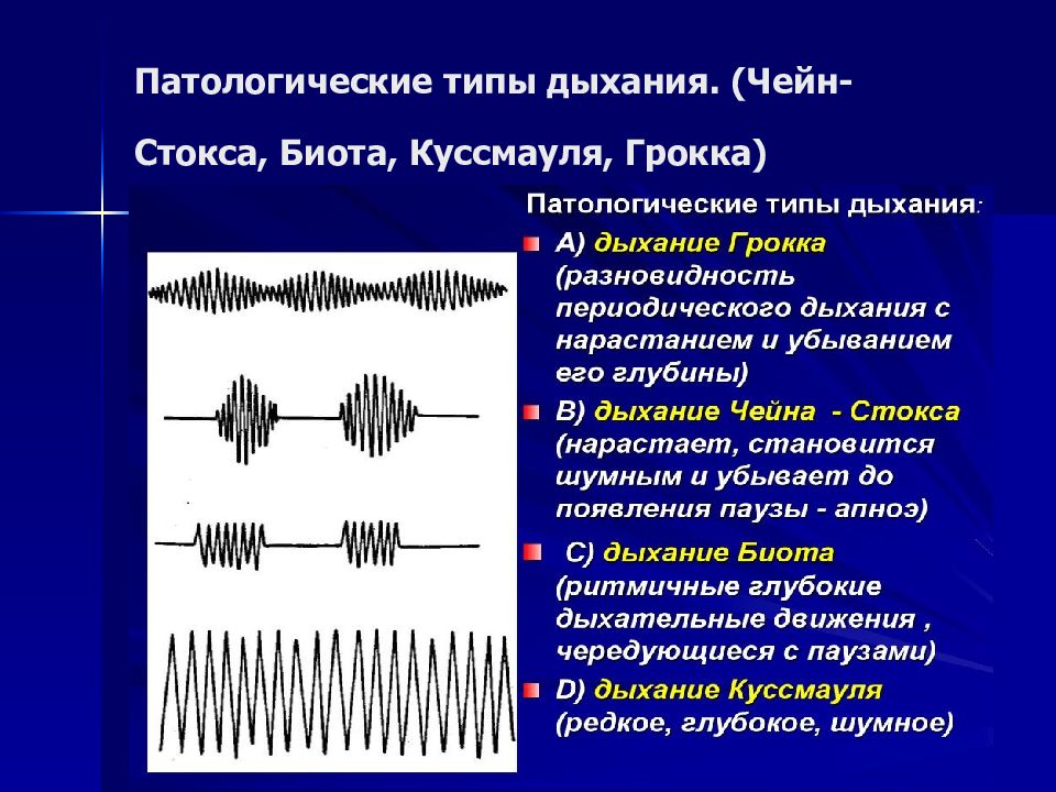 Патологическое дыхание рисунок